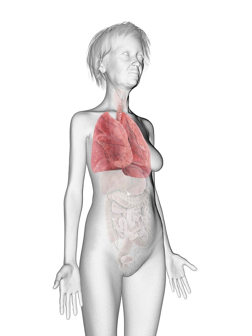 Illustration of an old woman's lung