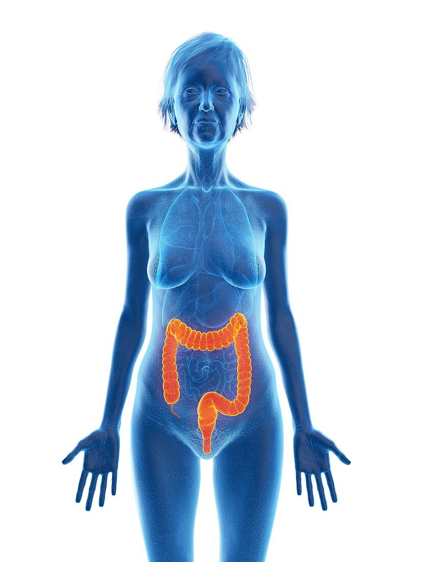 Illustration of an old woman's colon