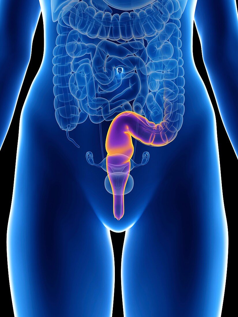 Illustration of a woman's rectum