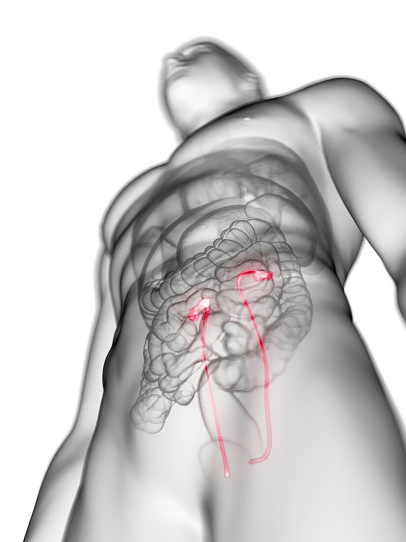 Illustration of a man's ureters