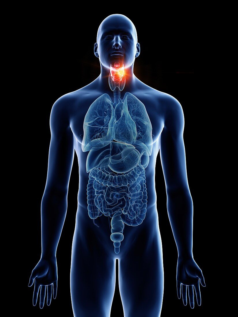 Illustration of a man's larynx cancer