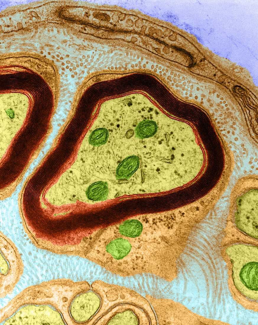 Cross-Section of Nerve, TEM