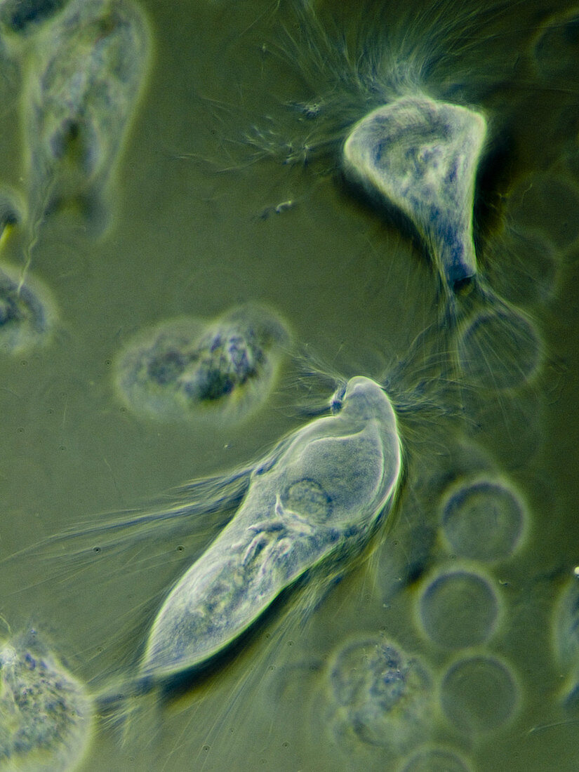 Protozoa (Trichonympha sp.), LM