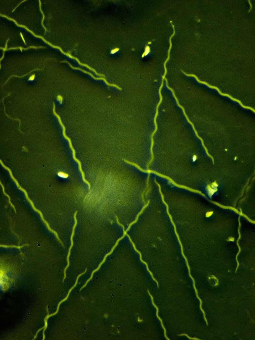 Spyrochaetes bacteria, LM