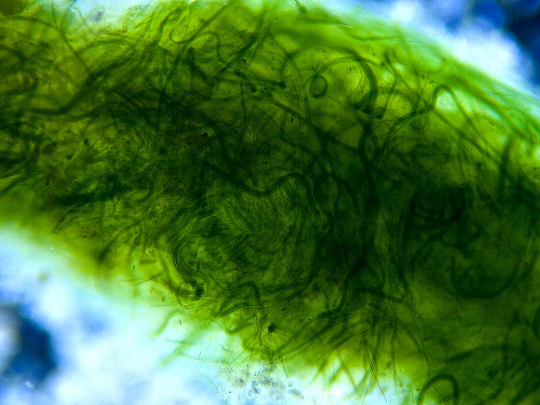 Cyanobacteria, LM