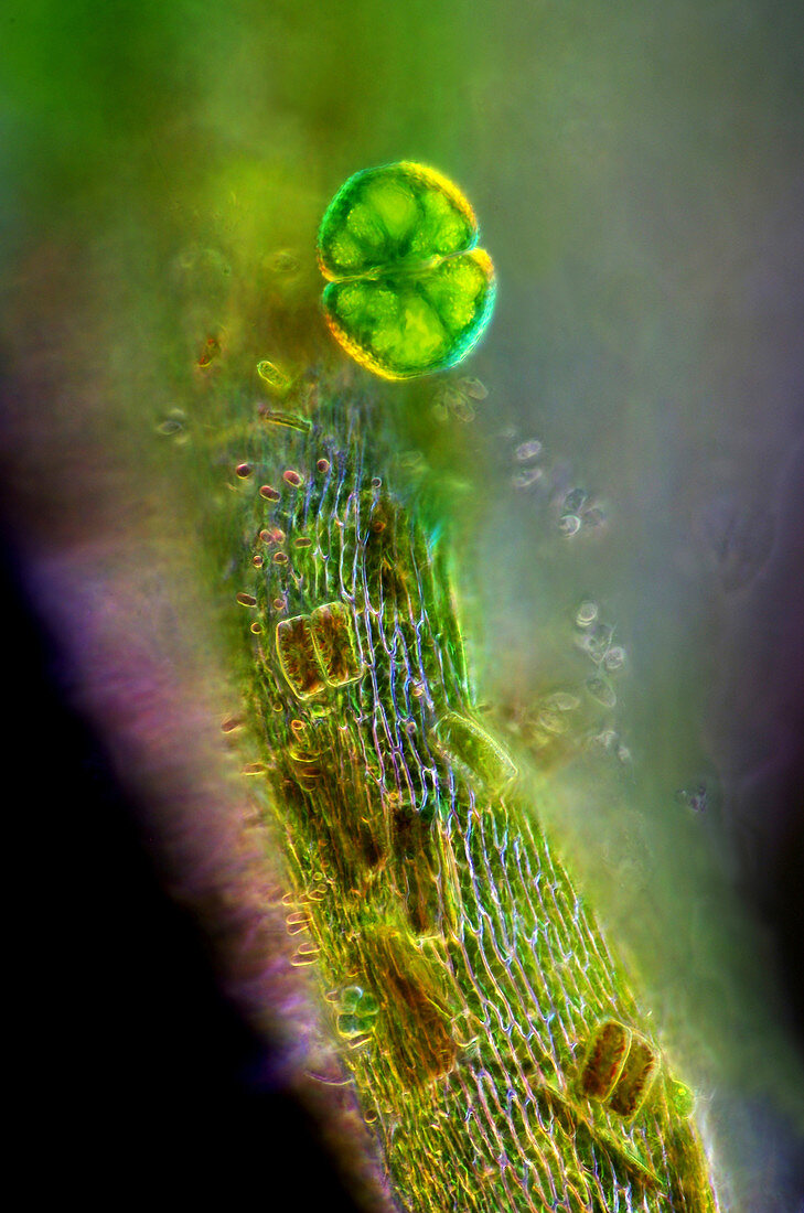 Cosmarium and Diatons on Sphagnum Leaf, LM