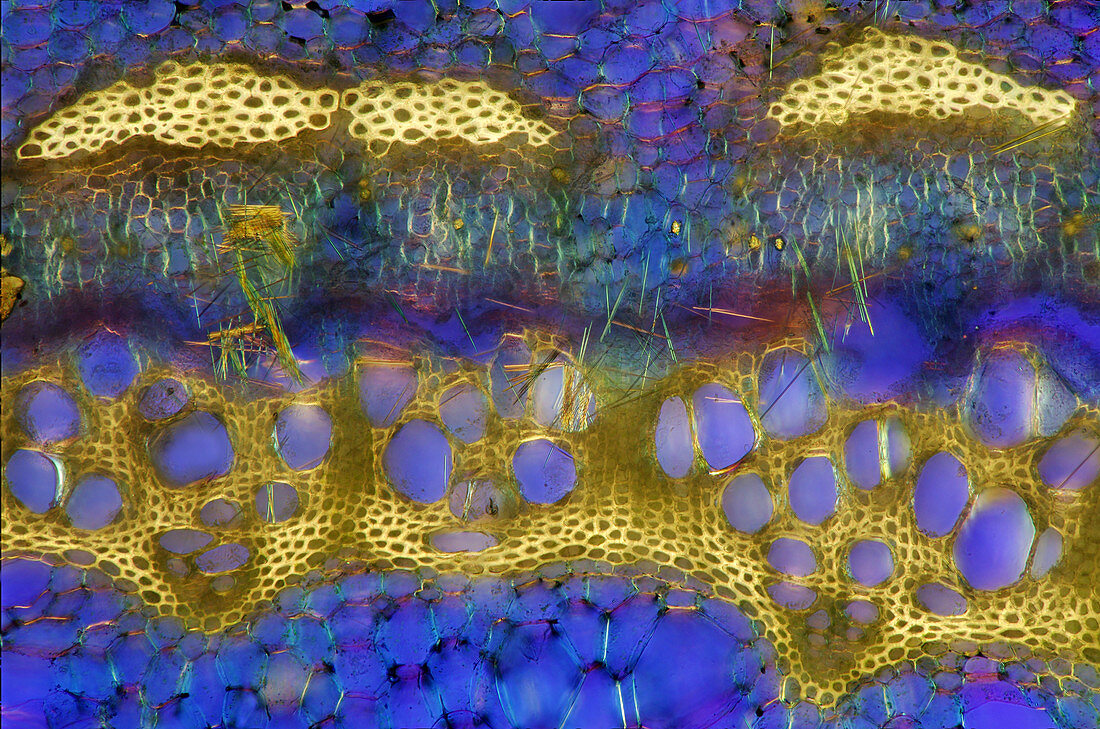 Parthenocissus Tissue, Polarized LM