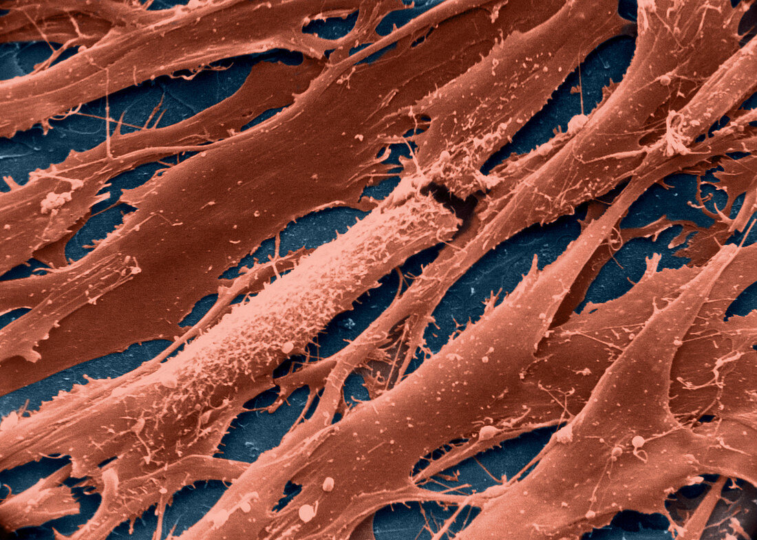 Fibroblasts, SEM