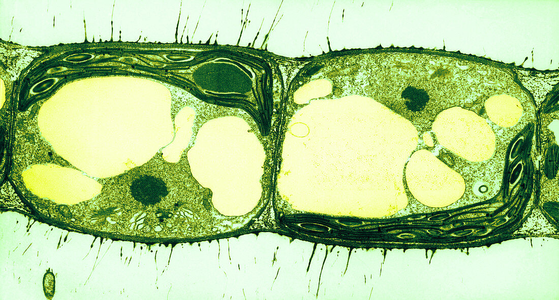 Algae Cell Division, Cylindrocapsa brebissonii