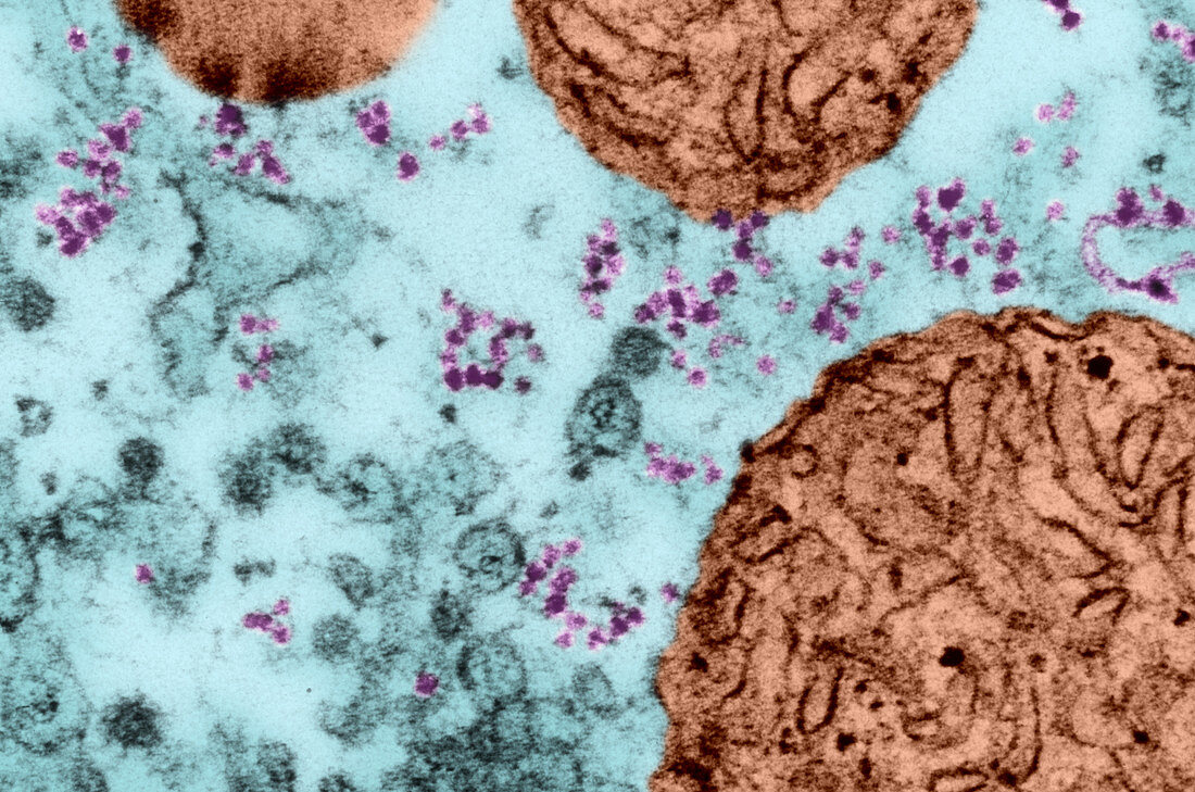 Mitochondria and Polysomes, TEM