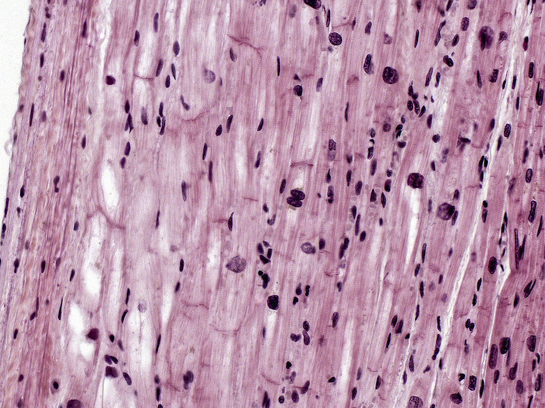 Cardiac Muscle with Purkinje Fibres, LM