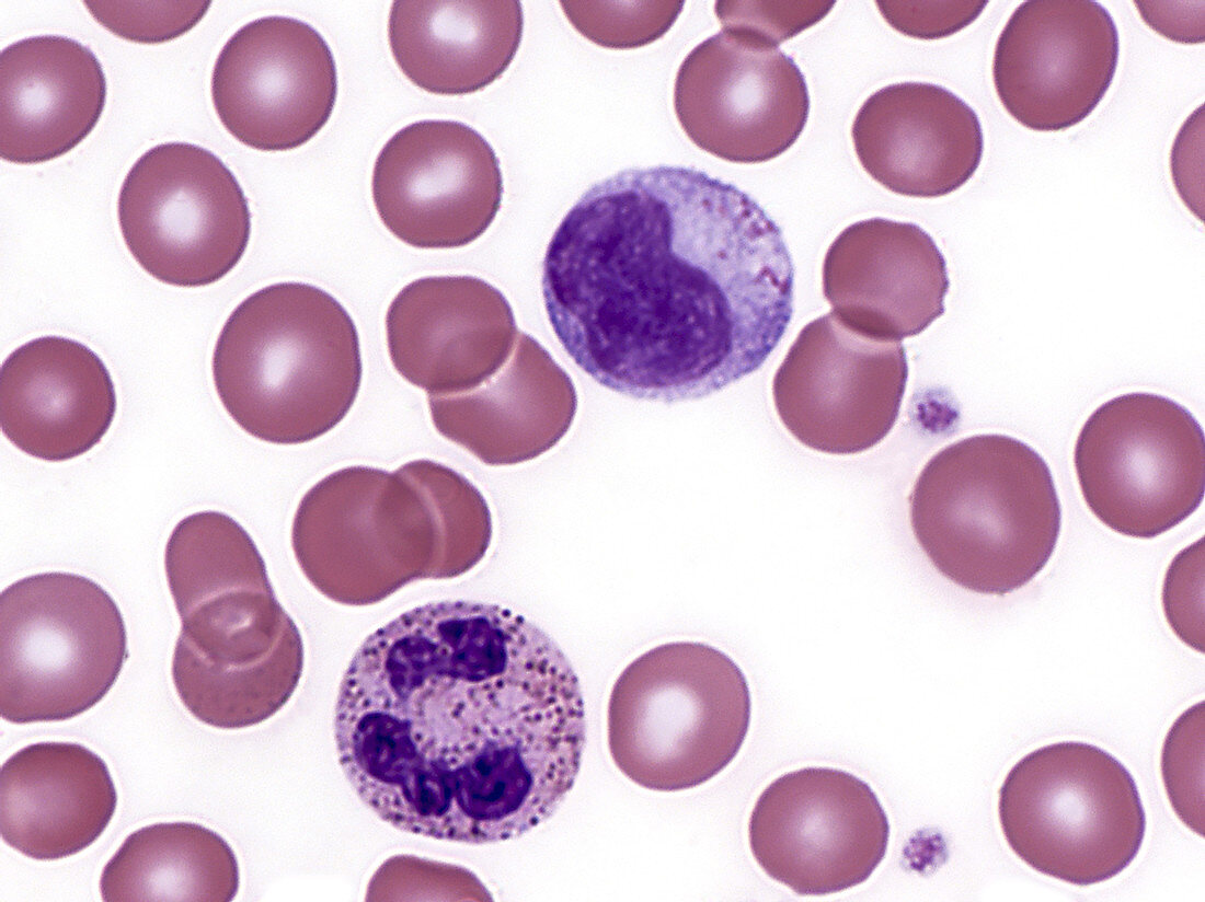 Red and White Blood Cells, LM