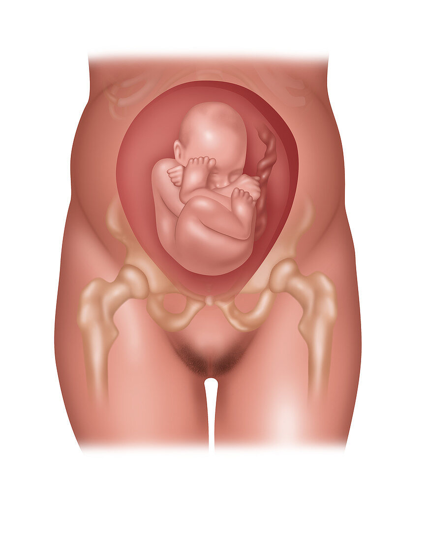 Foetus in Breech Position, Illustration
