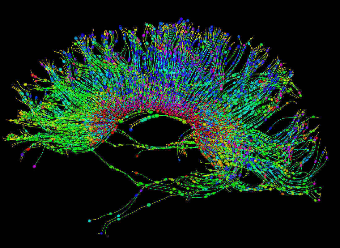 Brain, Fibre Tractography Image