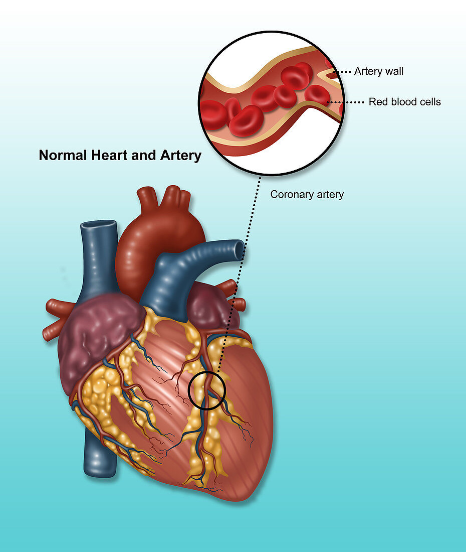 Normal Heart and Artery, Illustration
