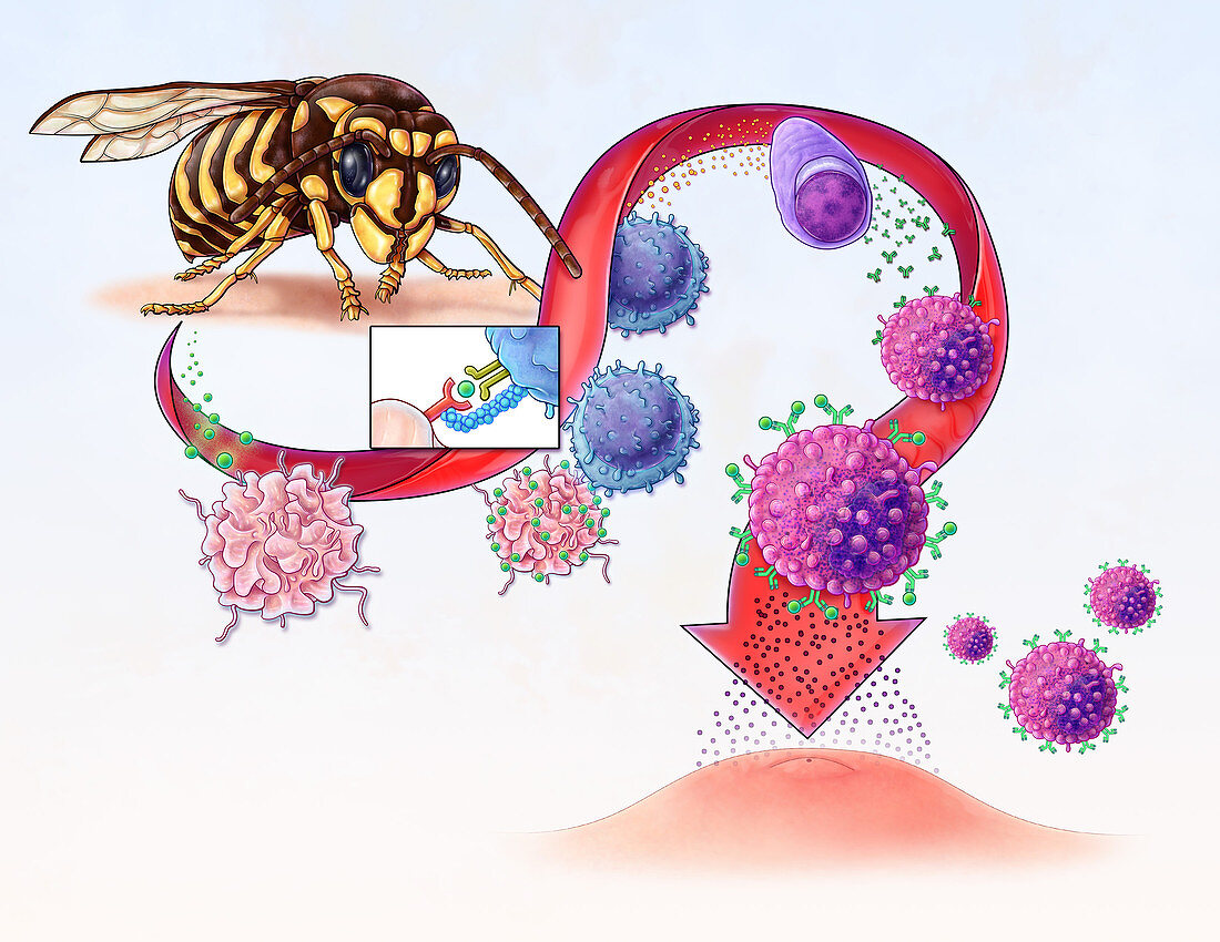Allergy Development, illustration