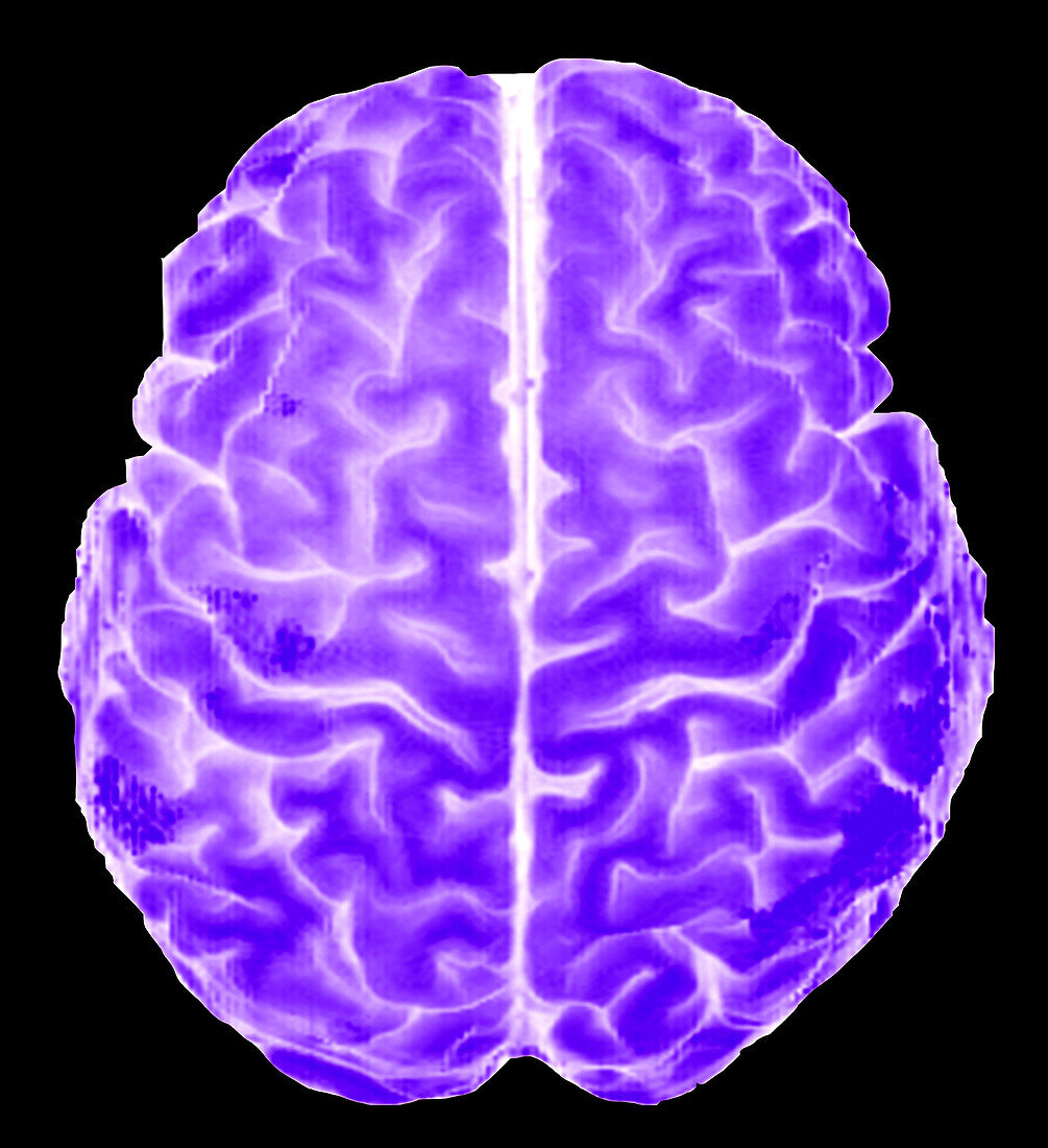 Enhanced 3D Surface Rendering of Brain