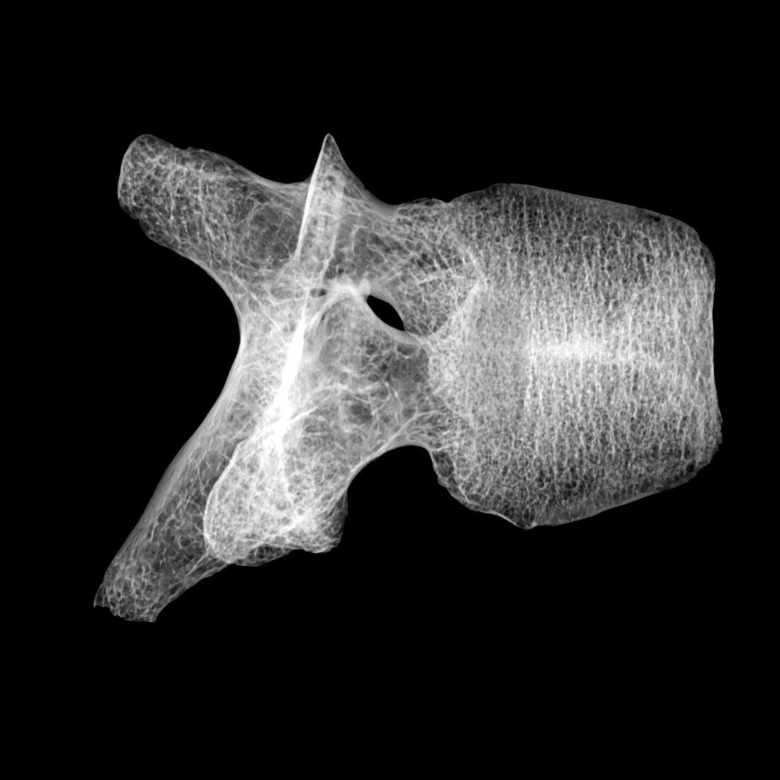 Human Vertebra T5, X-ray