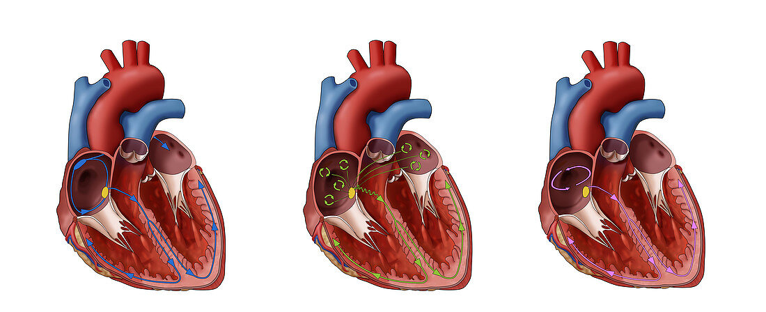 Heart, AFib and Atrial Flutter, Illustration