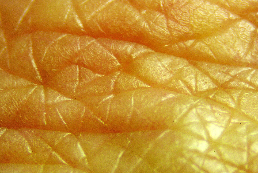 Wrinkled skin of an 80 year old man