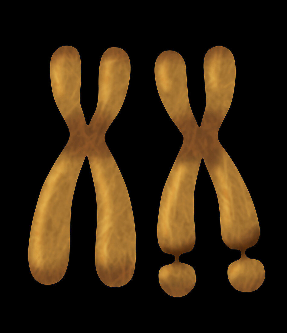Fragile X Chromosome, Illustration