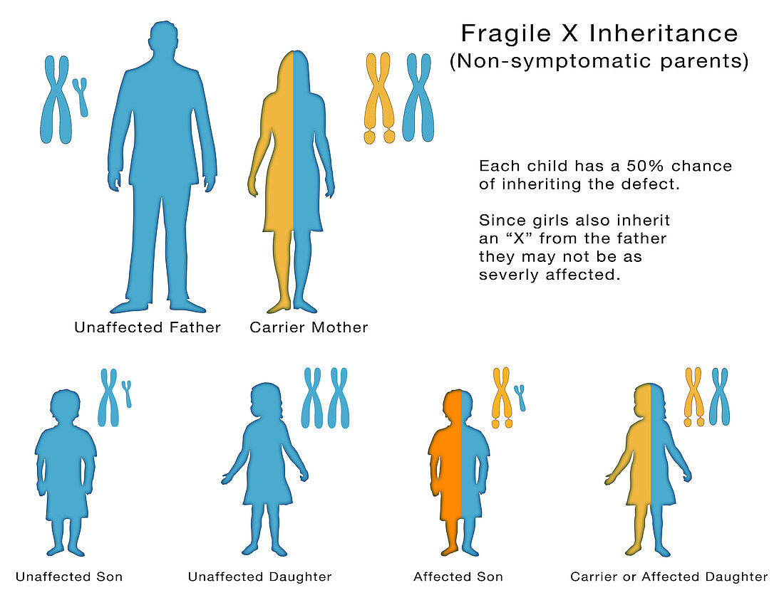 Fragile X Inheritance, Illustration