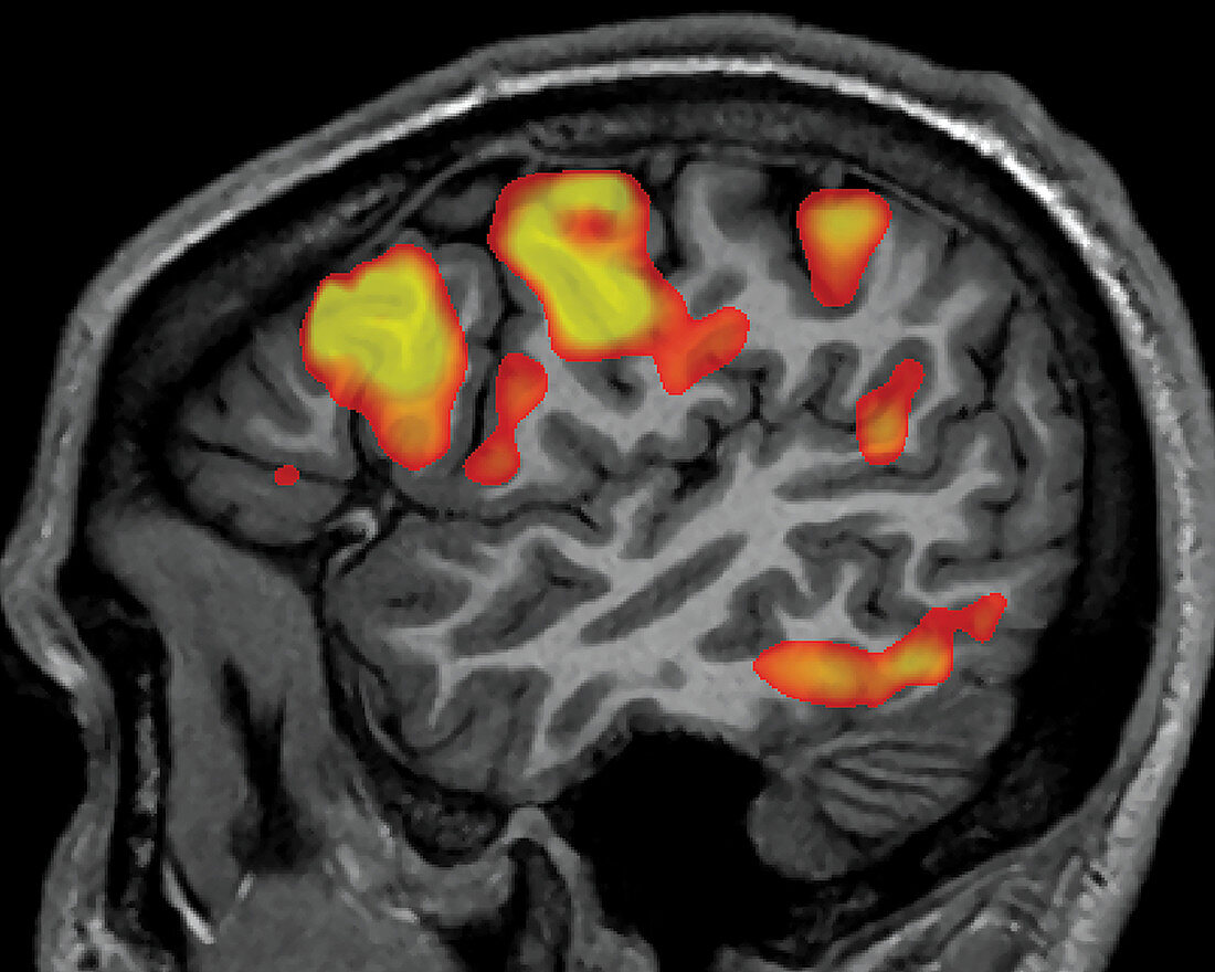 fMRI during Sentence Completion