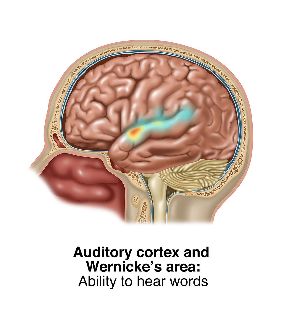 Auditory Cortex and Wernicke's Area, Illustration