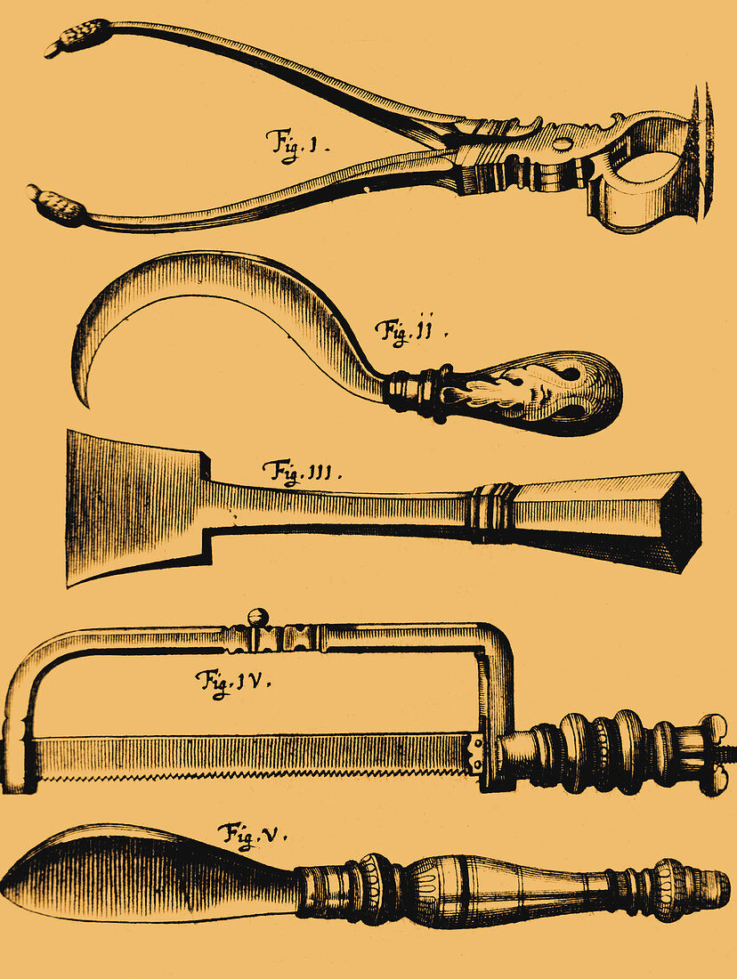 Amputation Instruments, 1772