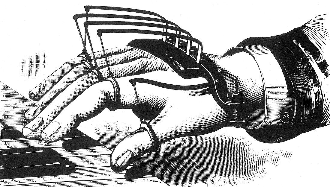 Atkins' Finger-Supporting Device, 1881