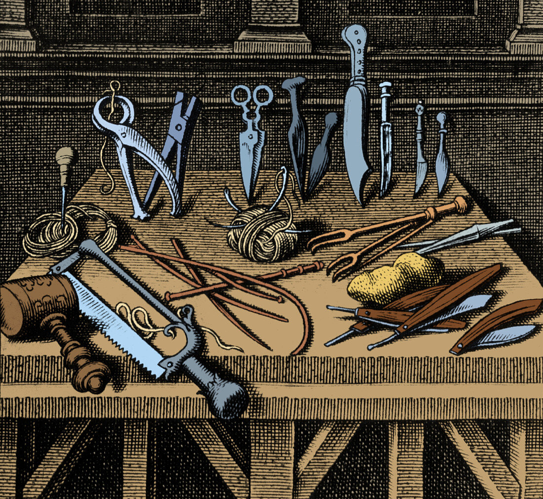 Surgical Equipment, 16th Century