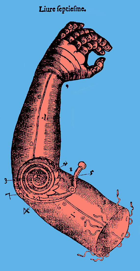 Artificial Arm Designed by Ambroise Pare, 1564