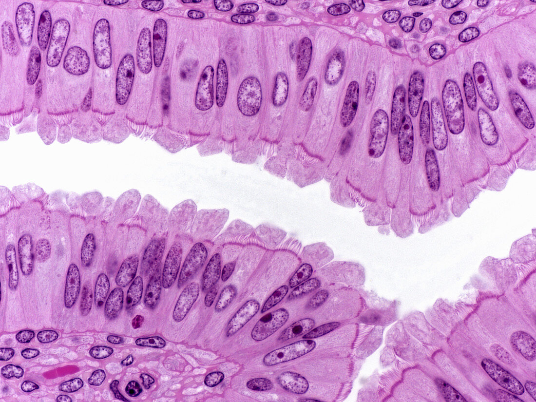 Oviduct, LM