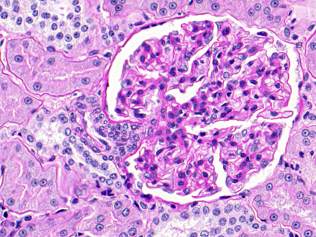Renal corpuscle, LM