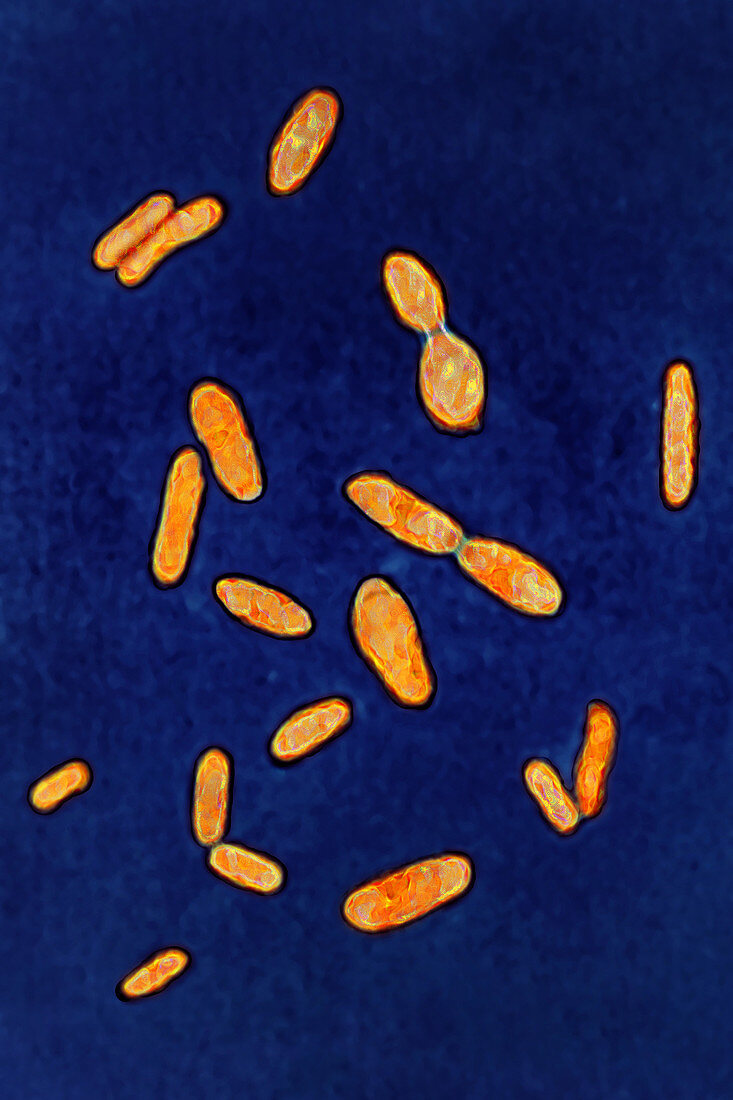 Clostridium tetani, LM