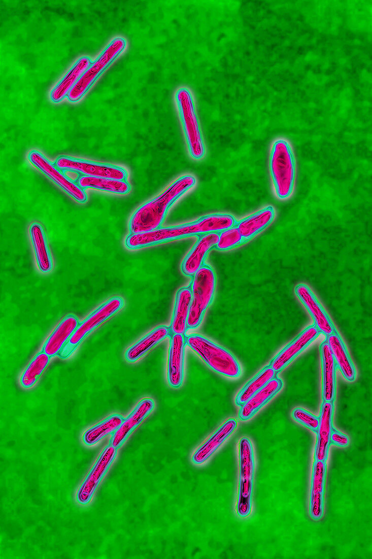 Clostridium botulinum, LM