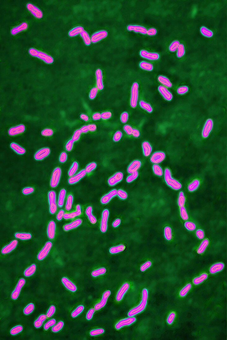 Bordetella pertussis, LM