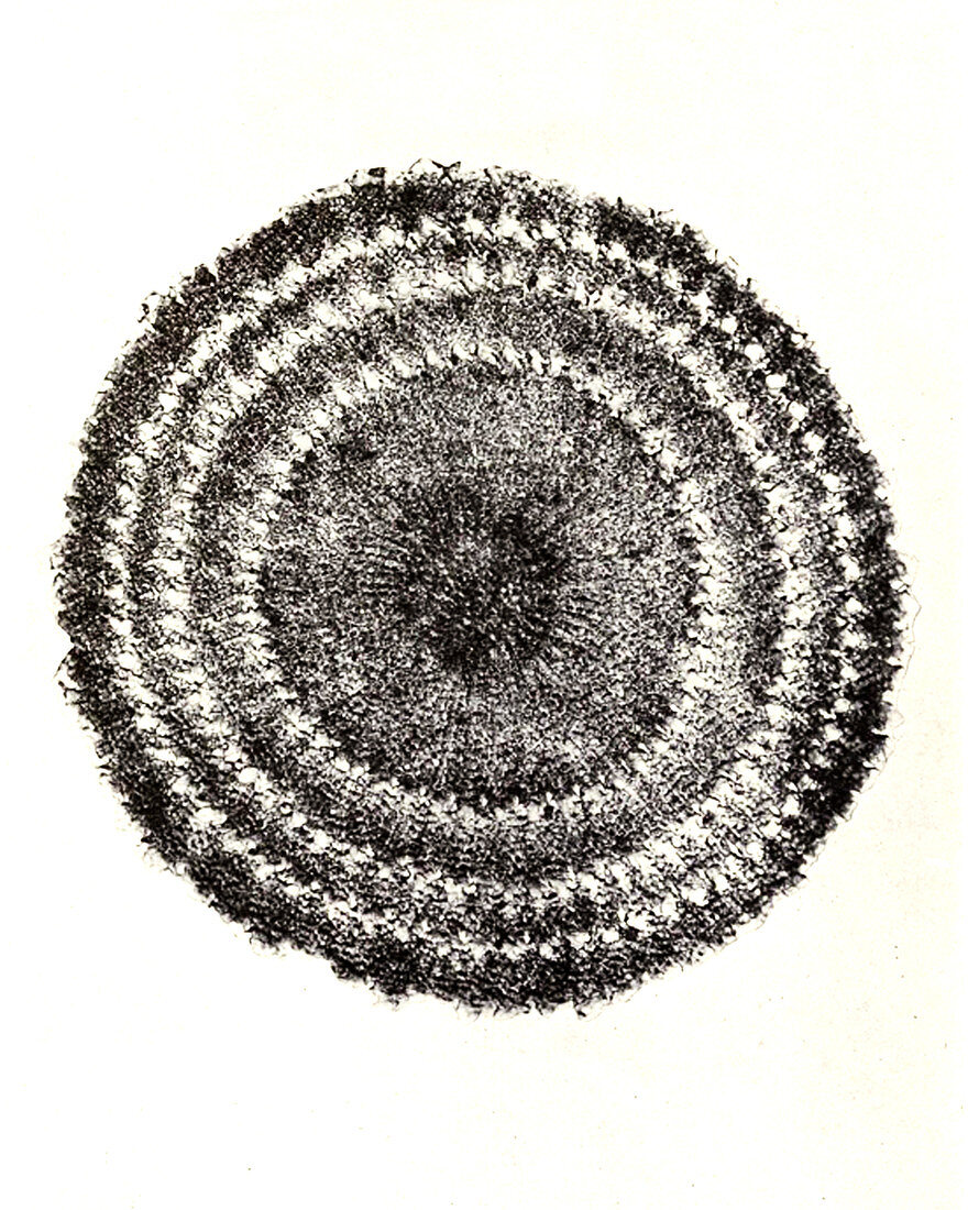 Echinus Spine Section, Early Photomicrograph