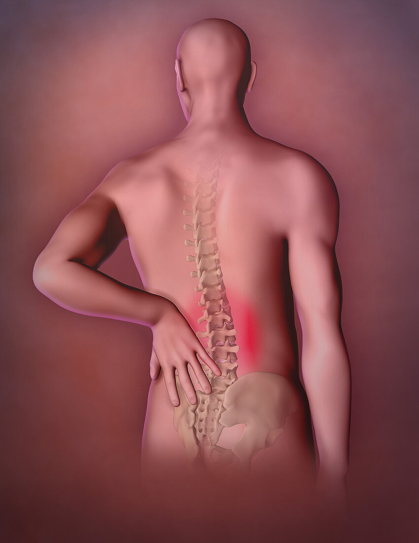 Back Pain, Illustration