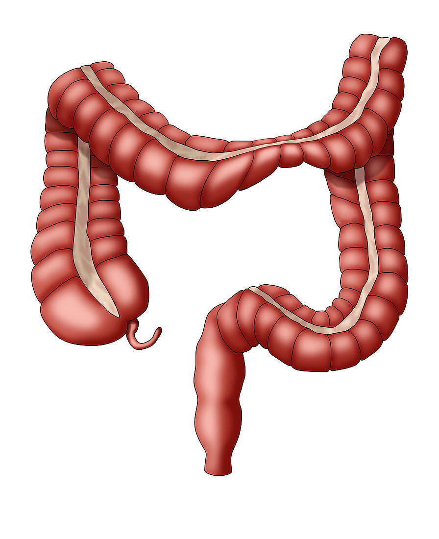 Irritable Bowel Syndrome (IBS), Illustration