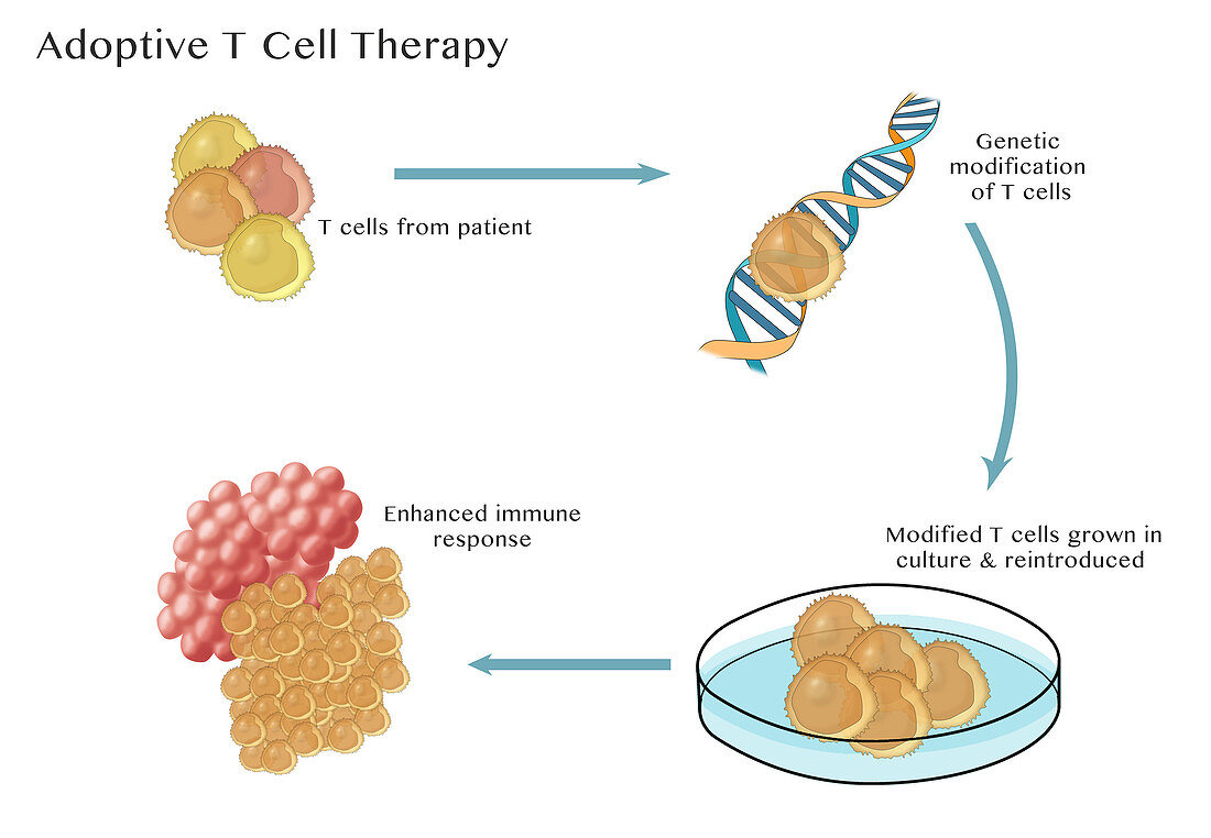 Adoptive T cell Therapy