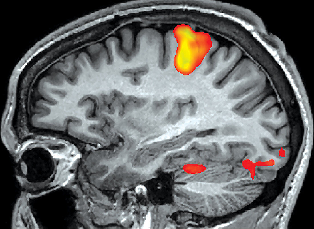 Finger Tapping, fMRI