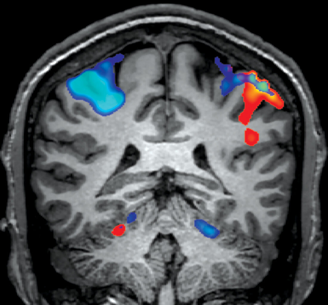 Sensory and Motor Task, fMRI