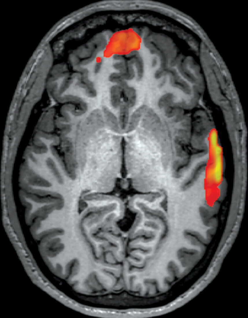 Hearing during Passive Listening, fMRI