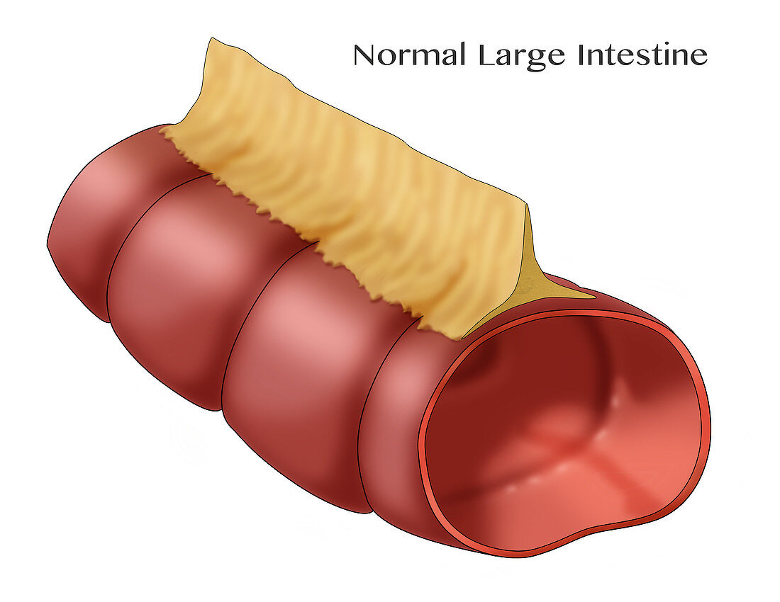 Small Section of Large Intestines, Illustration