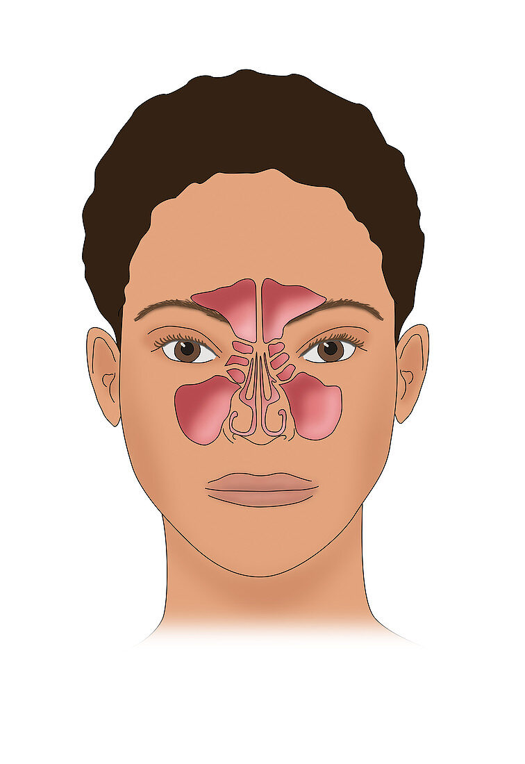 Sinus Anatomy, Illustration
