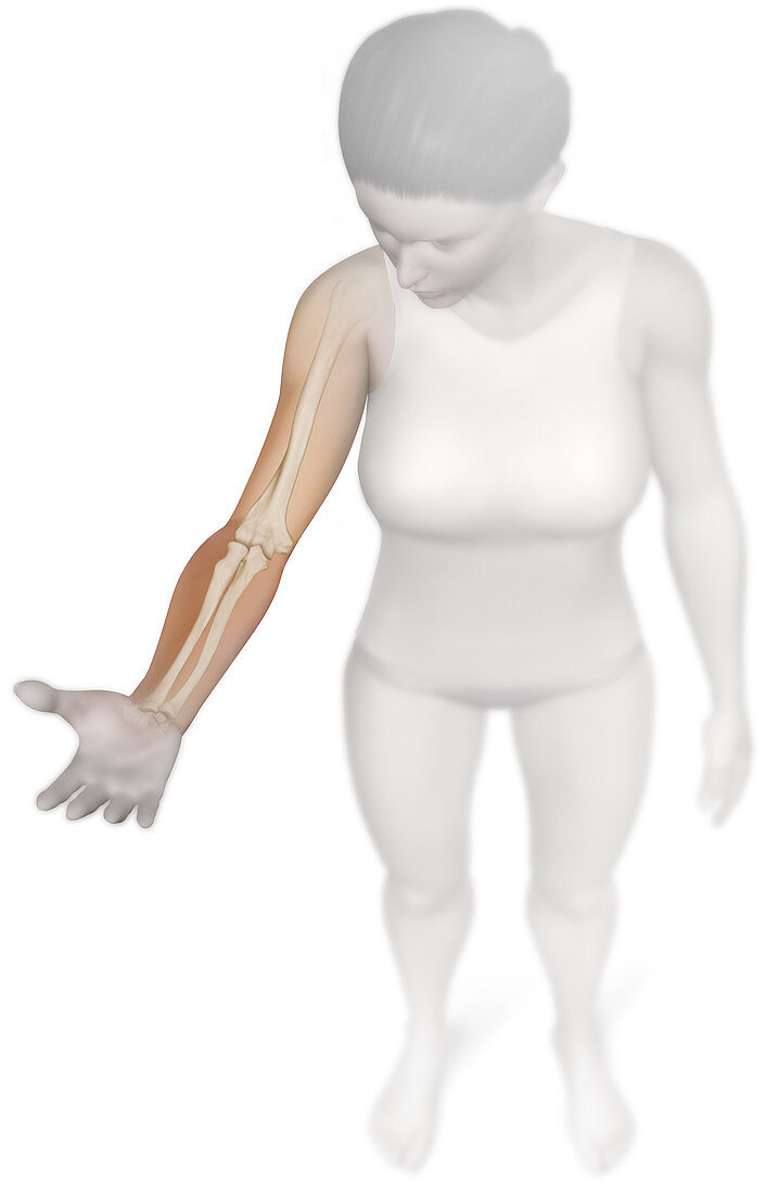 Hinge joint (elbow), illustration