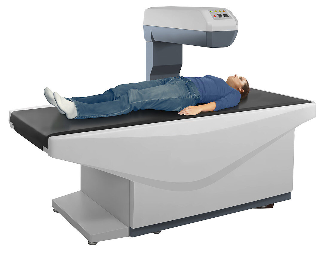 Bone mineral density testing, illustration