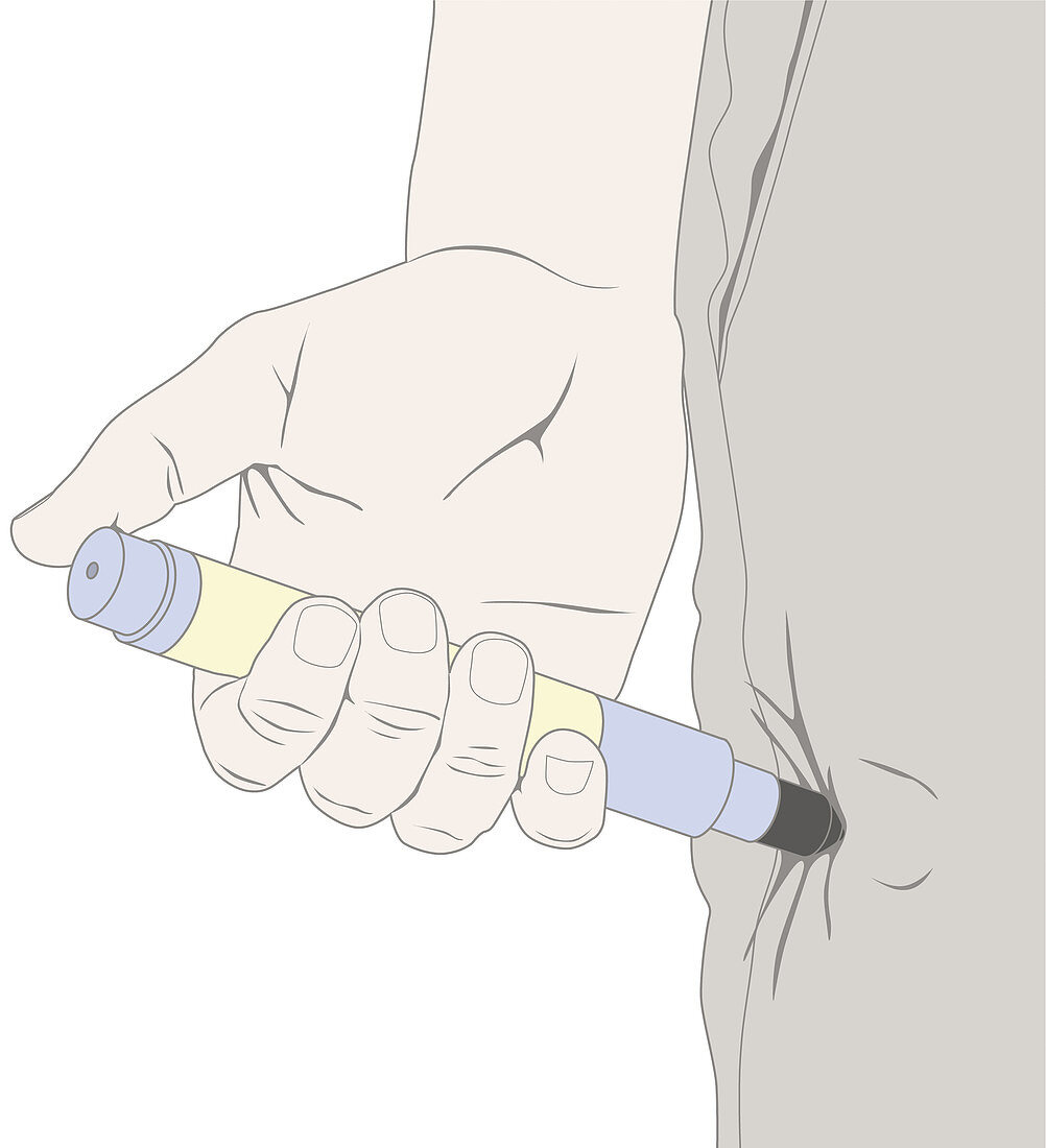 Epinephrine Autoinjector, illustration