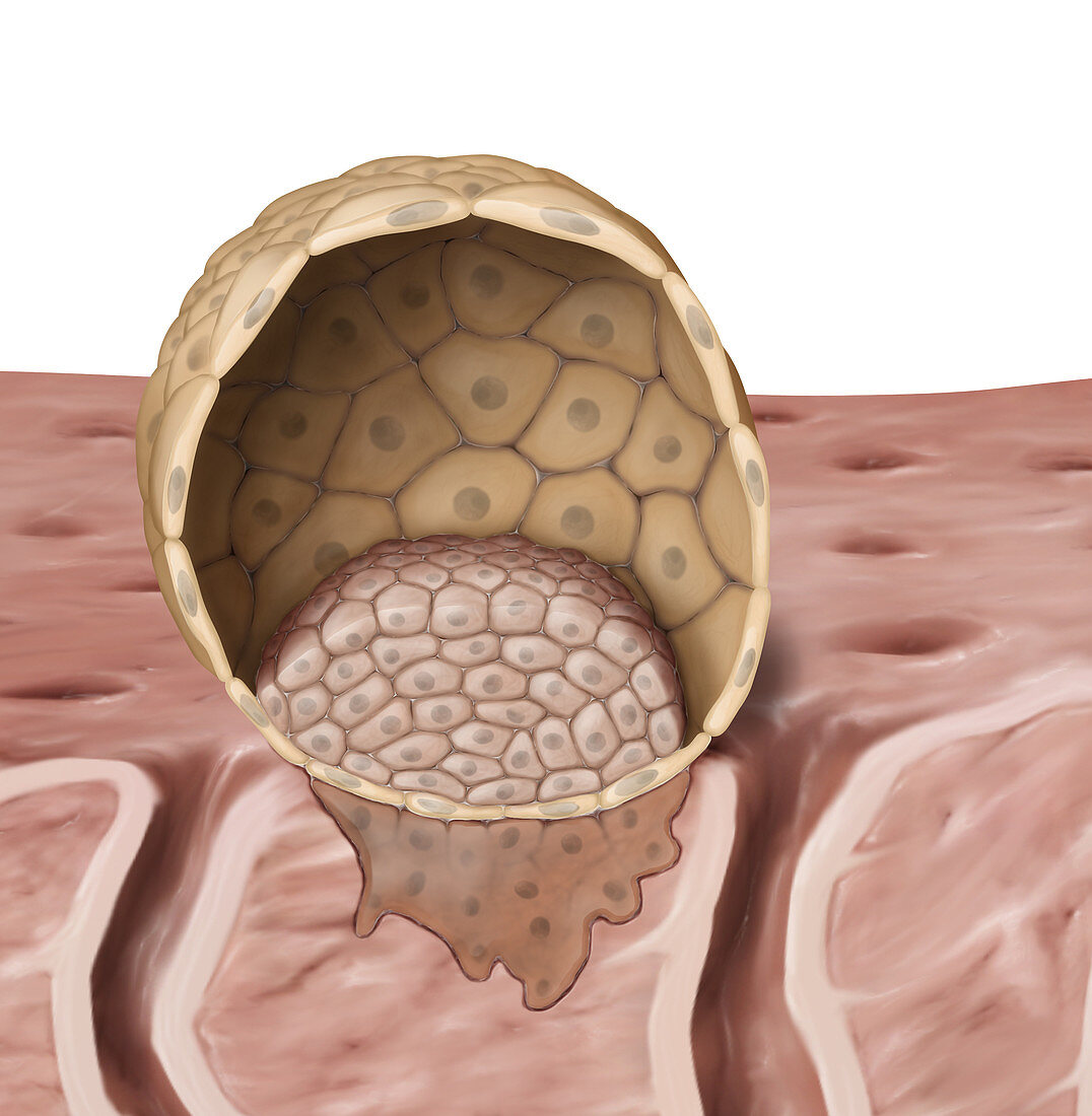 Blastocyst, illustration